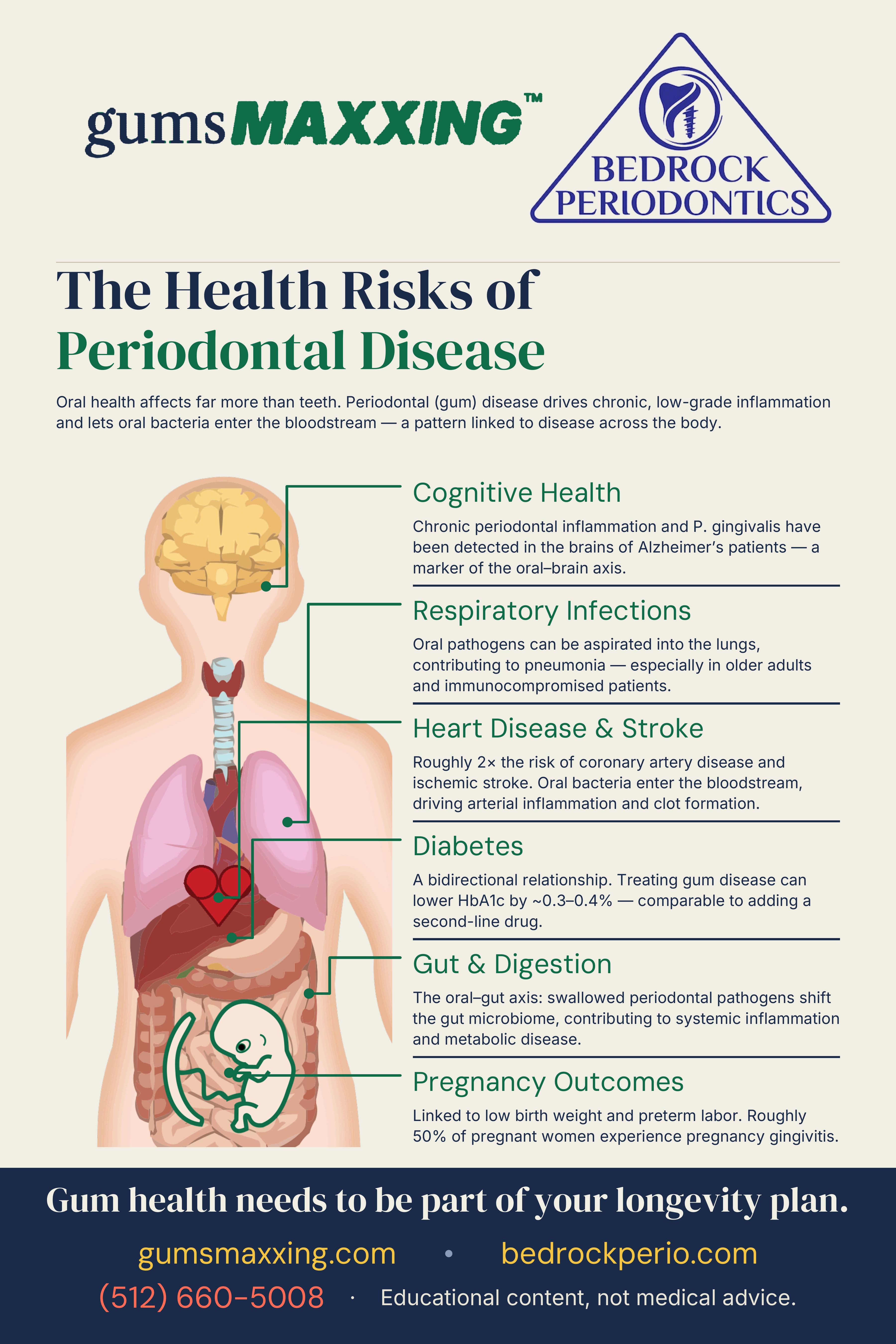 Poster: The Health Risks of Periodontal Disease — six systemic connections: cognitive health (Alzheimer's, oral-brain axis), respiratory infections (pneumonia), heart disease & stroke (2× risk of coronary artery disease and ischemic stroke), diabetes (treating gum disease can lower HbA1c by ~0.3–0.4%), gut & digestion (oral-gut axis), and pregnancy outcomes (~50% of pregnant women experience pregnancy gingivitis).